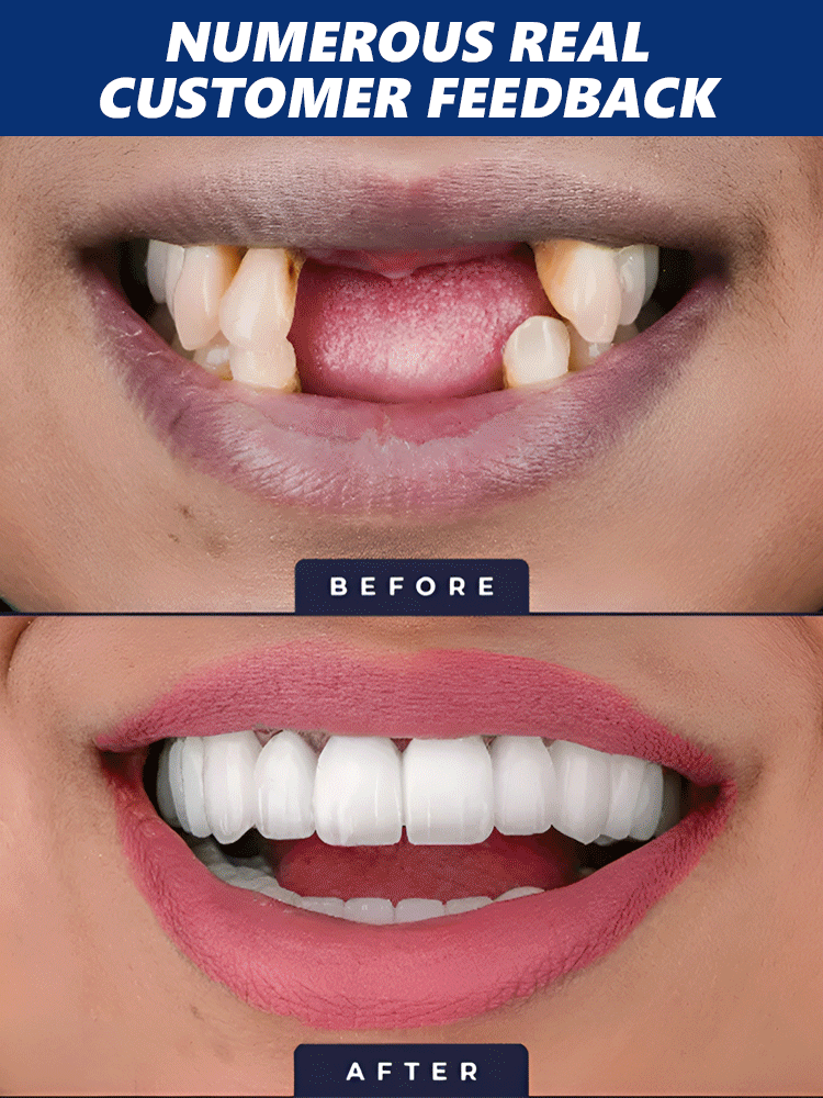 😱The truth dentists don't want you to know! Natural herbal extracts🌿 + exclusive bone regeneration factors, activating natural tooth root growth from the source, clinically proven 98% effective✅, helping you grow real teeth!