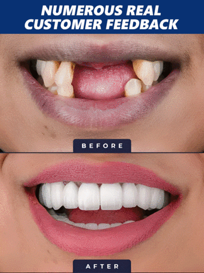 😱The truth dentists don't want you to know! Natural herbal extracts🌿 + exclusive bone regeneration factors, activating natural tooth root growth from the source, clinically proven 98% effective✅, helping you grow real teeth!