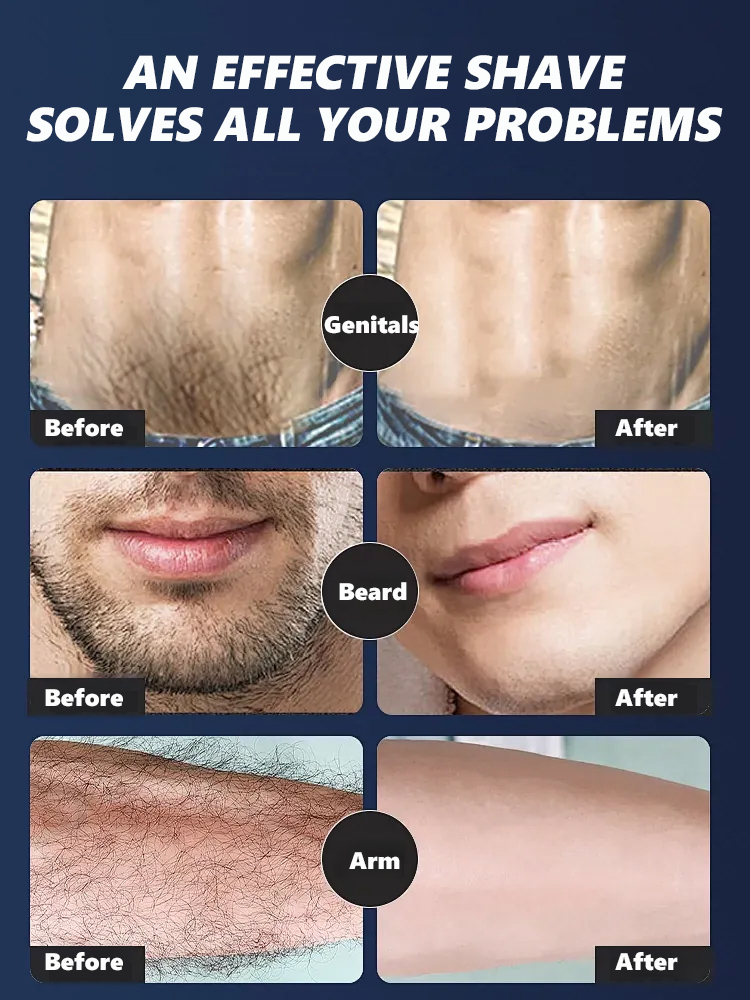 The latest full-body shaver developed by the University of Munich won first place at the Berlin exhibition! 🏆 Lifetime warranty.