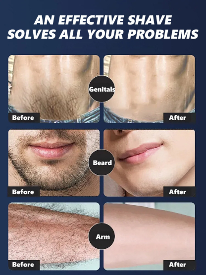 The latest full-body shaver developed by the University of Munich won first place at the Berlin exhibition! 🏆 Lifetime warranty.