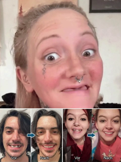 Stop hiding your teeth! Instantly achieve a million-dollar smile. Professional-grade kit. Witness the miracle! Get a perfect smile in just one second. Invisible and natural—corrects misaligned teeth.