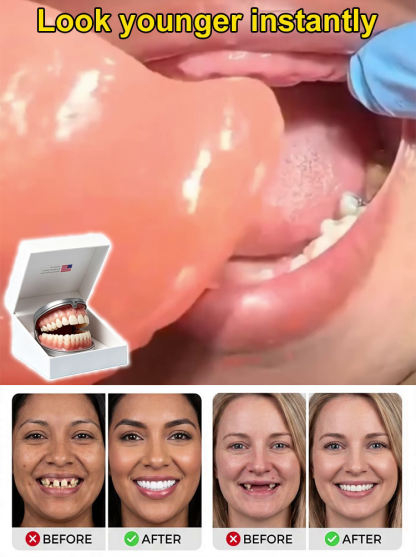 🍎✨10-Second Facial Reconstruction — Fill Your Wrinkles & Smooth Your Smile! Look 20 Years Younger Instantly!