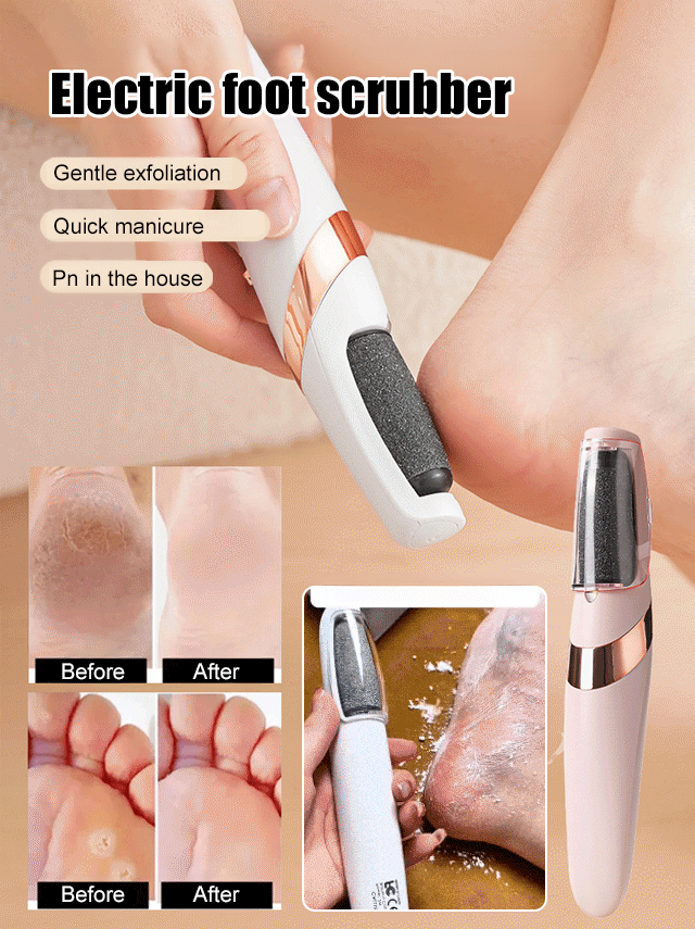 ✨🦶 Say goodbye to dry, rough heels! ✨Discover our innovative machine that purifies and softens the soles of your feet. No more suffering or hiding your feet—give them the care they deserve.