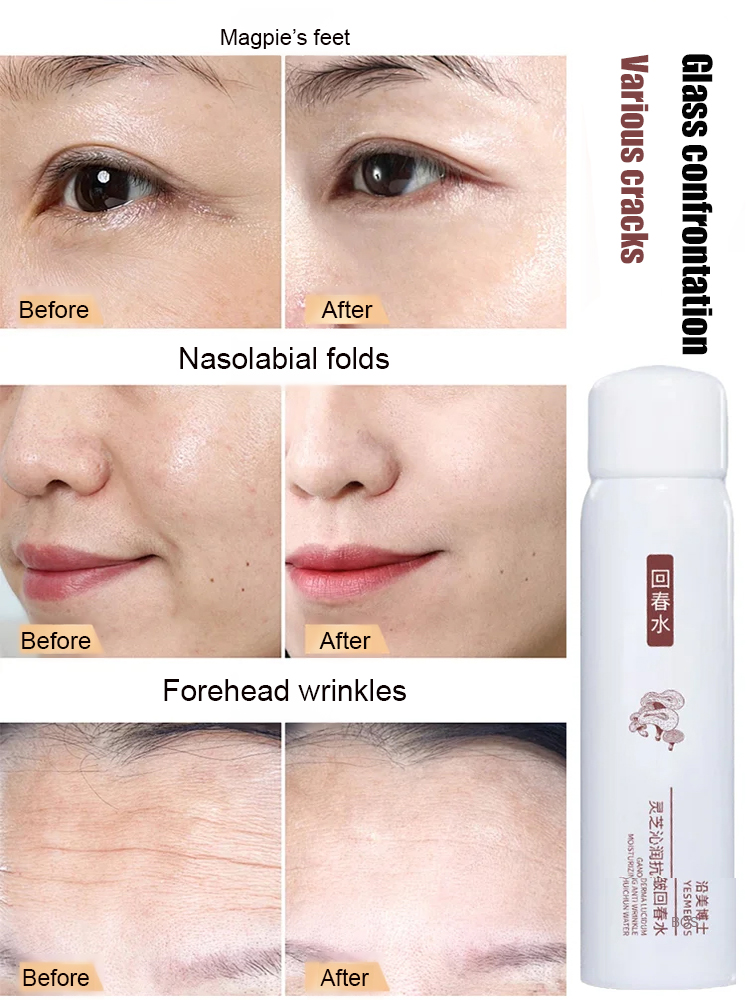 [Designed for those with eye wrinkles] Lingzhi Anti-Wrinkle Essence
