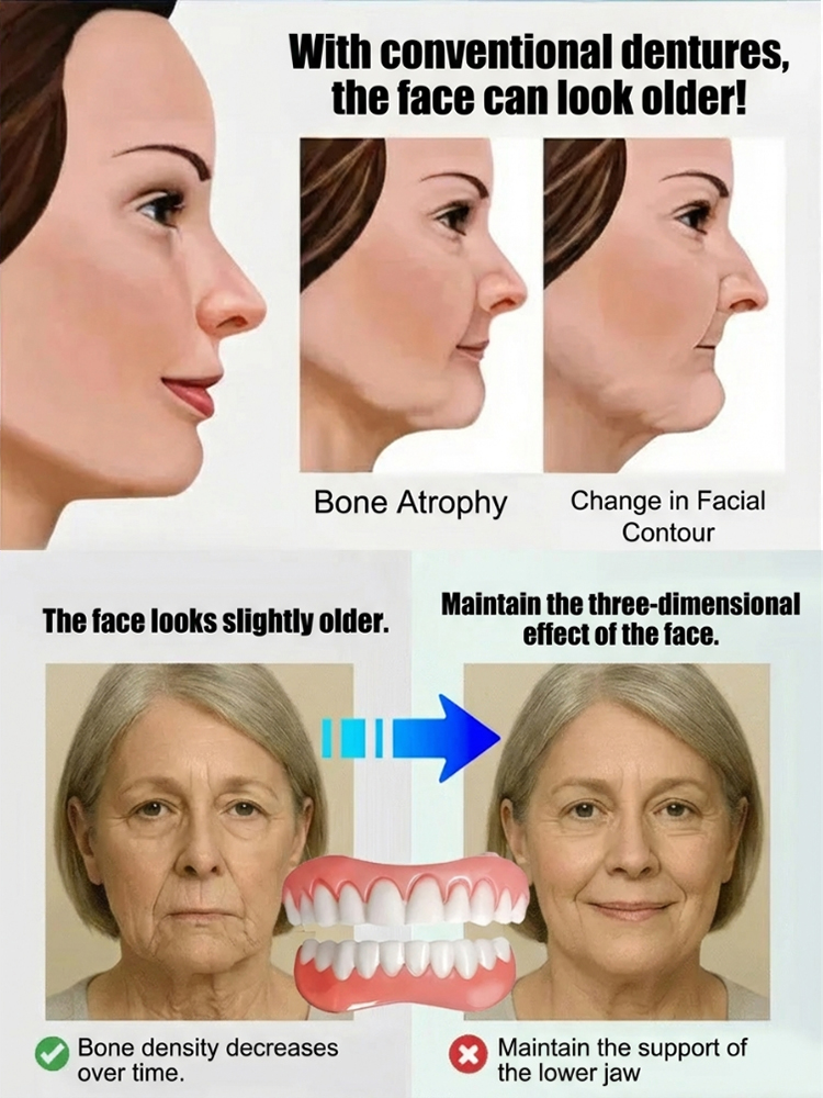 [Top Rated Customer] Natural Fit Denture Set