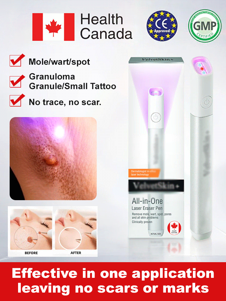 🤫The low-cost secret beauticians don't want you to know: Laser mole removal pen! ✨