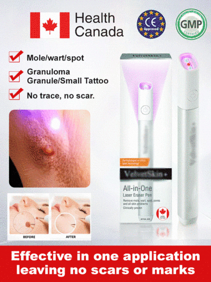 🤫The low-cost secret beauticians don't want you to know: Laser mole removal pen! ✨