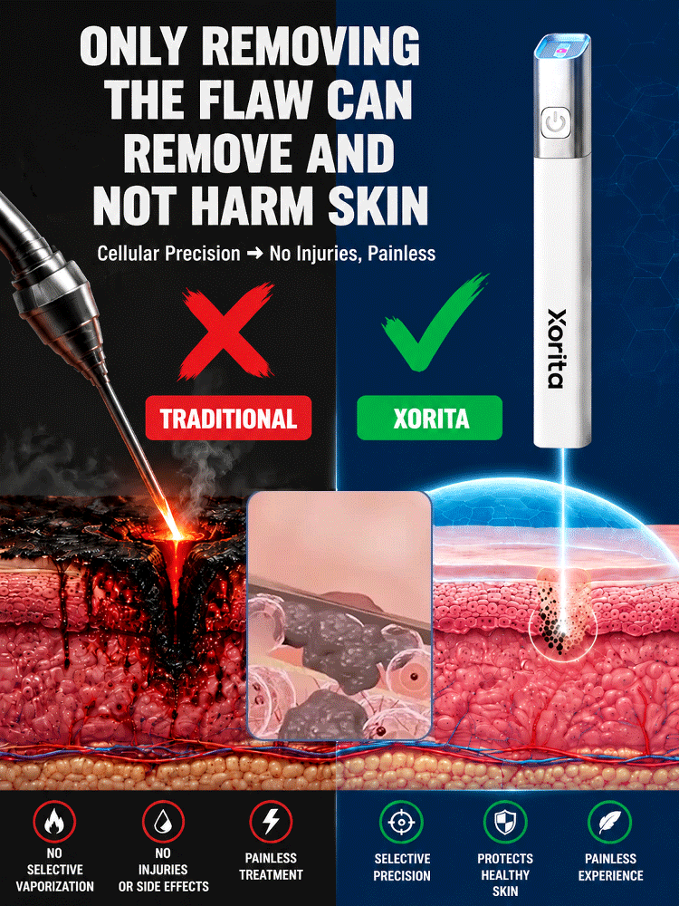  🚀 Medical Plasma Tech: 1 Session to Flawless Skin, No more skin tags!