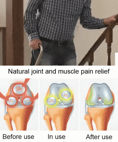 【No fruit, full refund】Yale University, in collaboration with the USA, has developed the latest cherry saplings ❤ No need for pollination / shipped with soil and branches / bear fruit in the next month