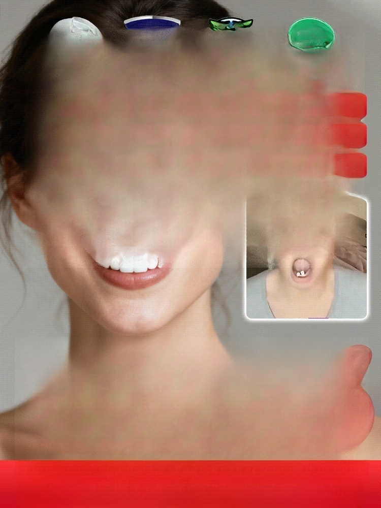 Natural Smile Customized Braces: A New Choice for Invisible Orthodontics, the Ultimate Solution for Dental Problems.