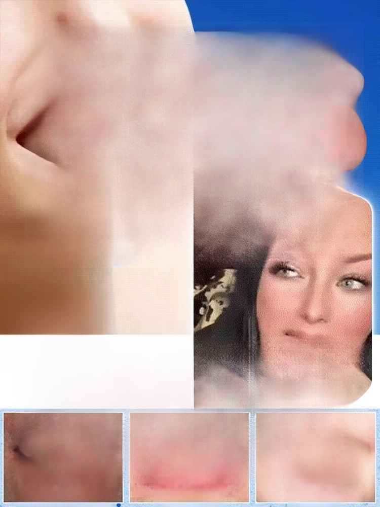 Natural Smile Customized Braces: A New Choice for Invisible Orthodontics, the Ultimate Solution for Dental Problems.