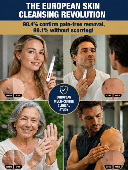  🚀 Medical Plasma Tech: 1 Session to Flawless Skin, No more skin tags!