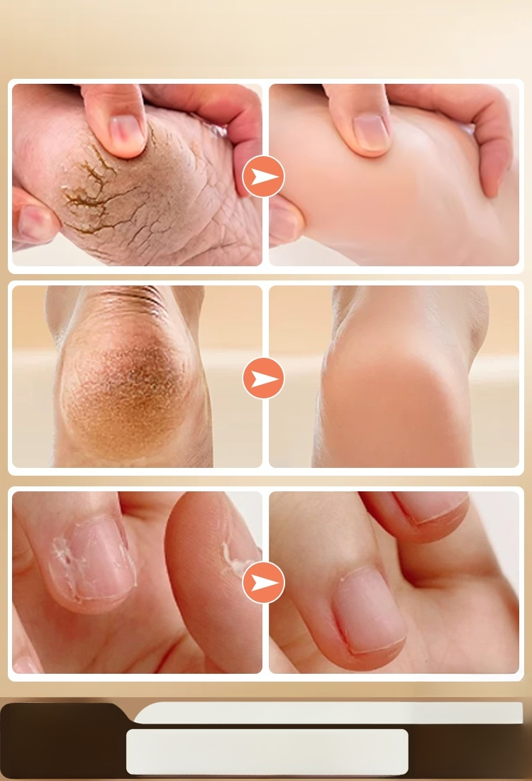 [ผิวเนียนนุ่มและกระจ่างใส] เครื่องขัดเท้าไฟฟ้าแบบ ล้างทำความสะอาดได้ รุ่น LCD