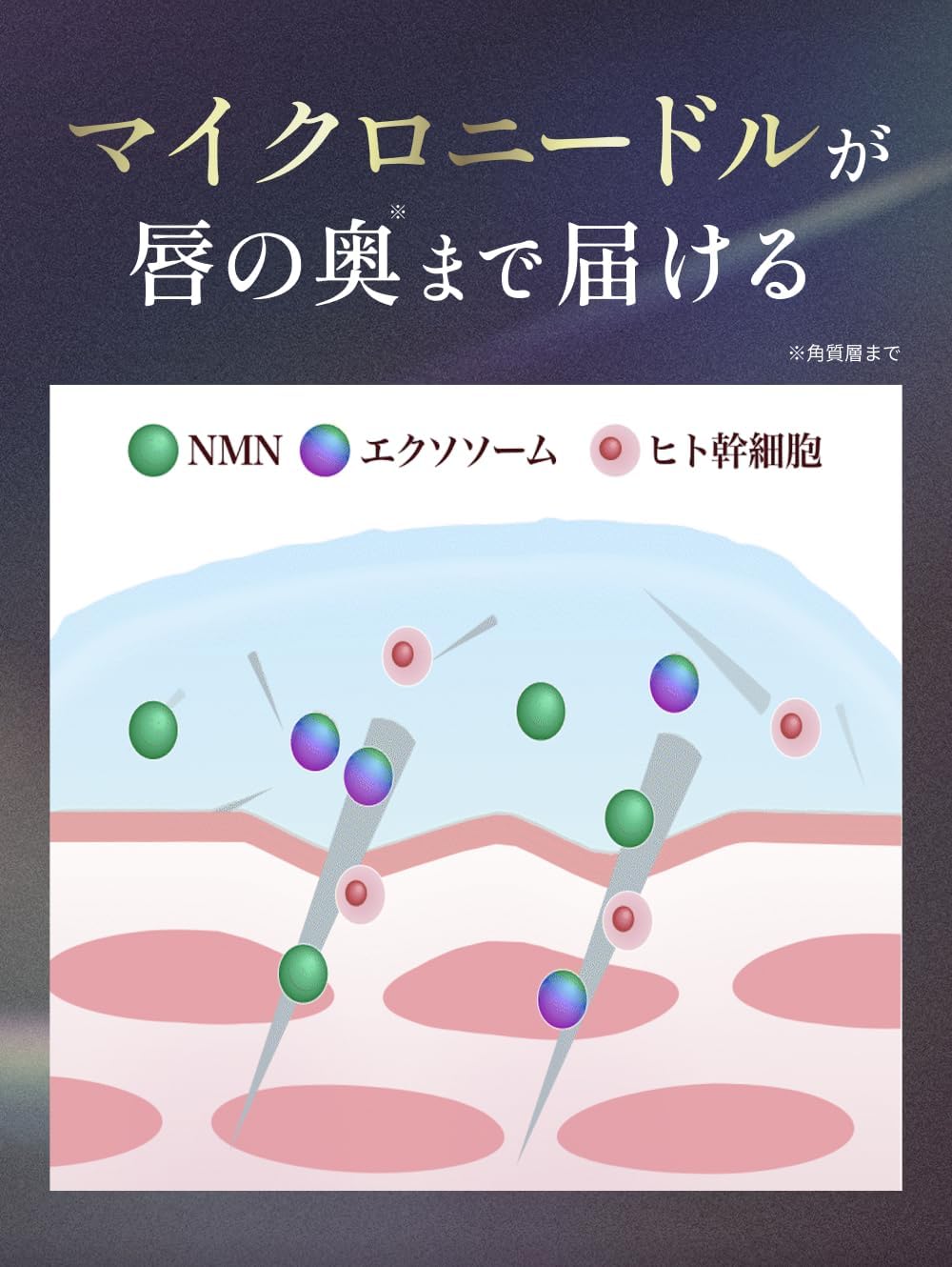 ダーマリッププランパー