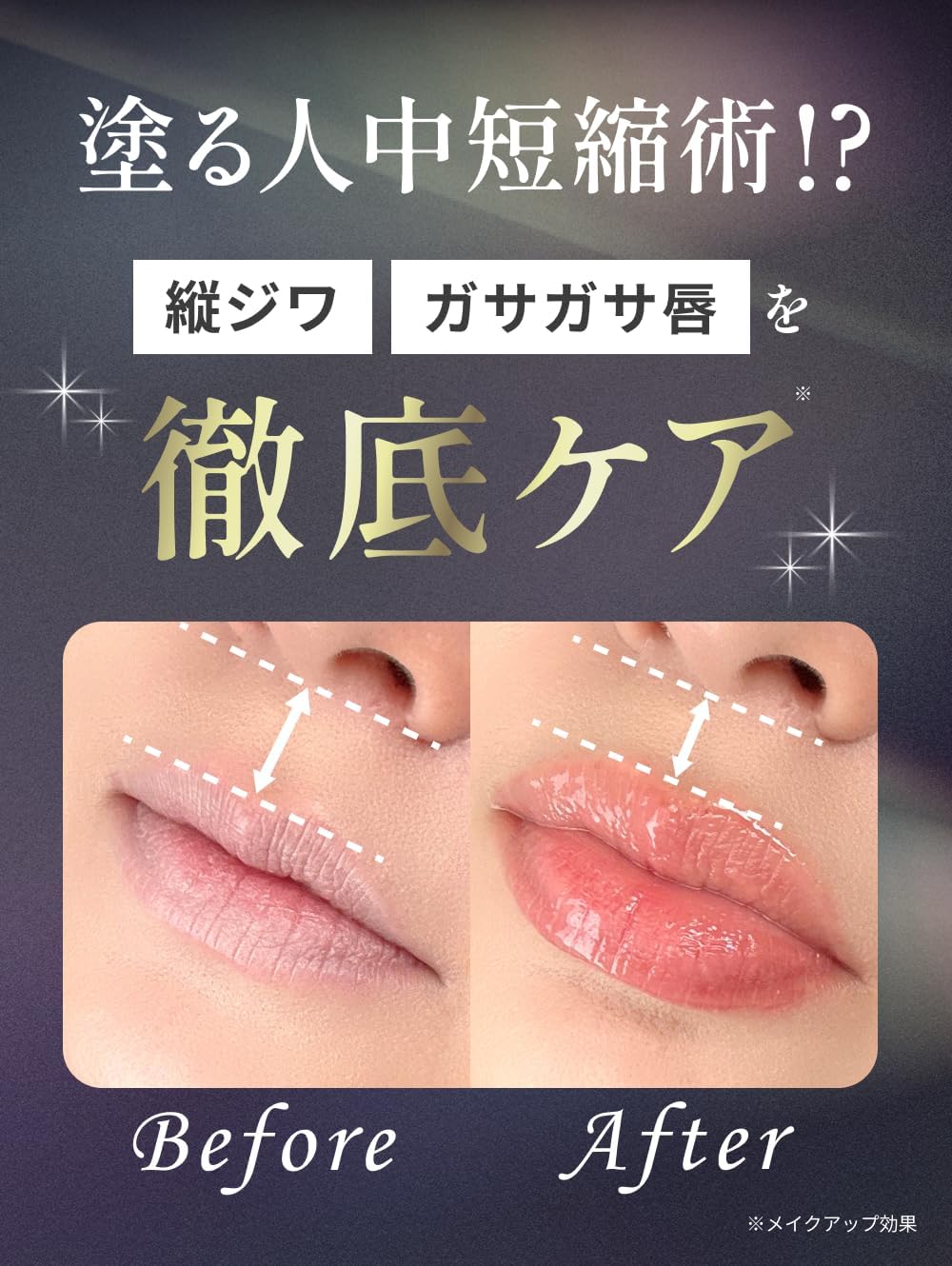 ダーマリッププランパー