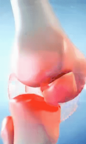 20240805_101126_240.gif