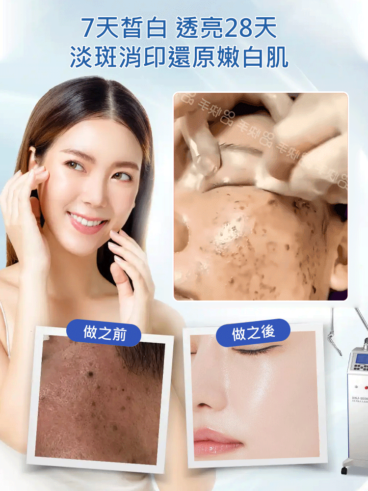 【老斑黃斑一抹消】淡斑尿素霜