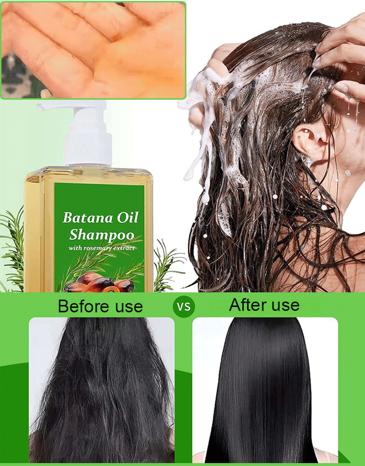 【Rapid hair growth in 7 days!】Hair growth shampoo