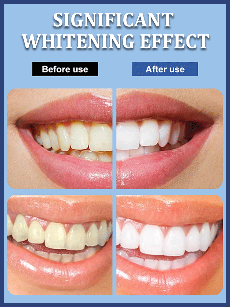 [Whitening with One Brush] Hyaluronic Acid Brightening Toothpaste