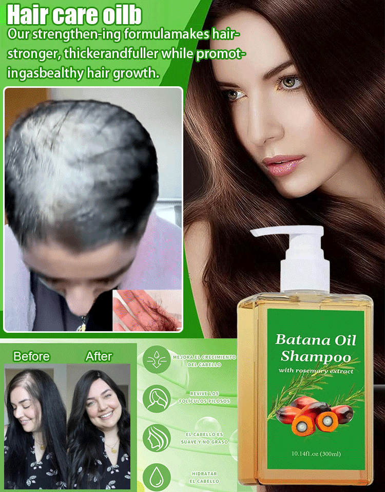 【Rapid hair growth in 7 days!】Hair growth shampoo