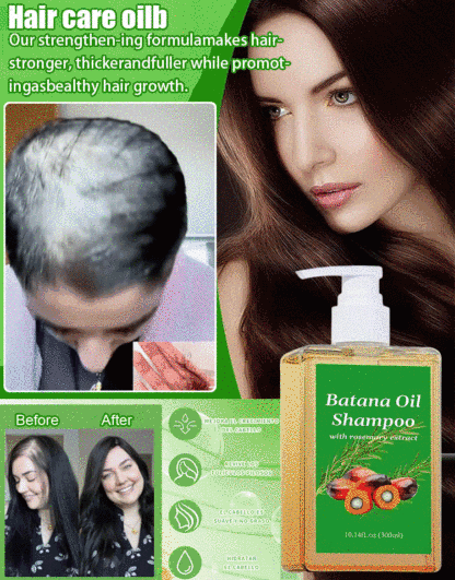 【Rapid hair growth in 7 days!】Hair growth shampoo