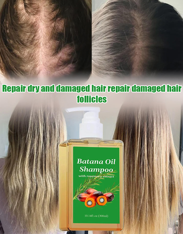 【Rapid hair growth in 7 days!】Hair growth shampoo