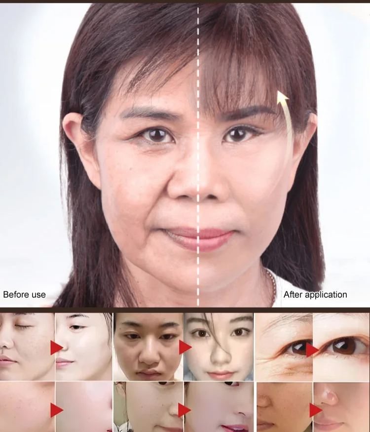 Peptide needle-filled collagen cream