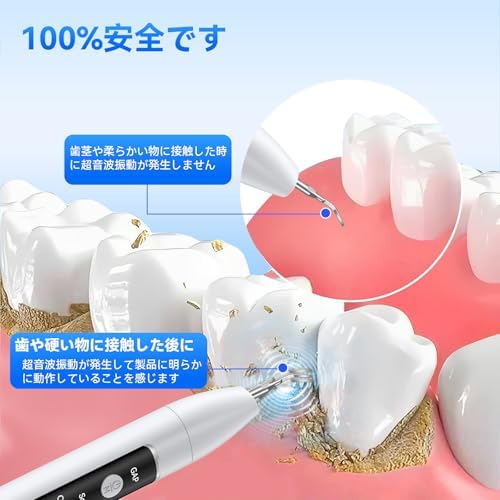 超音波歯クリーナー 口腔洗浄器 携帯用歯清潔器 超音波振動 口腔ケア 3つモード調節可能 USB充電式 内蔵LEDライト クリーニングキット 日本語取扱説明書 ホワイト