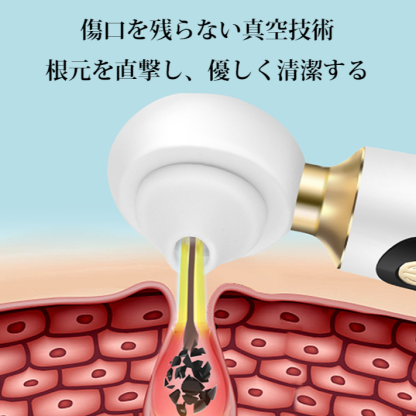 ドイツ輸入可視化黒ずみとニキビ吸引器