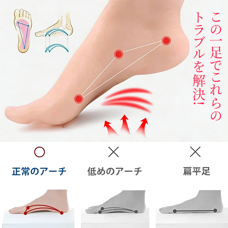 足のトラブルを解決するアーチ構造 正常なアーチを形成し扁平足の負担を軽減する図解