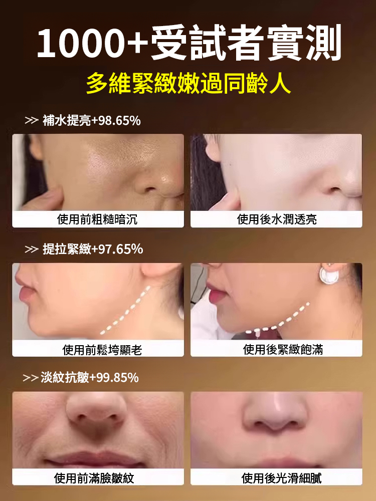 自然填充重組膠原泡