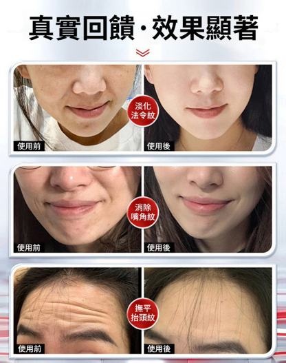 童顏緊緻拉皮霜