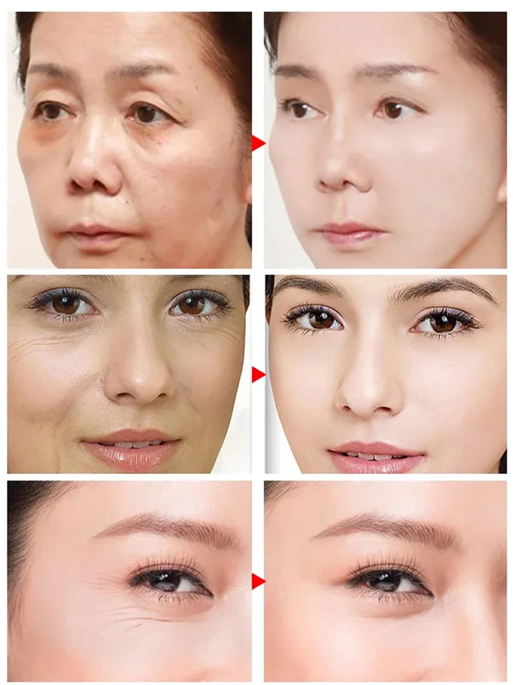 重組膠原蛋白抗皺精華液