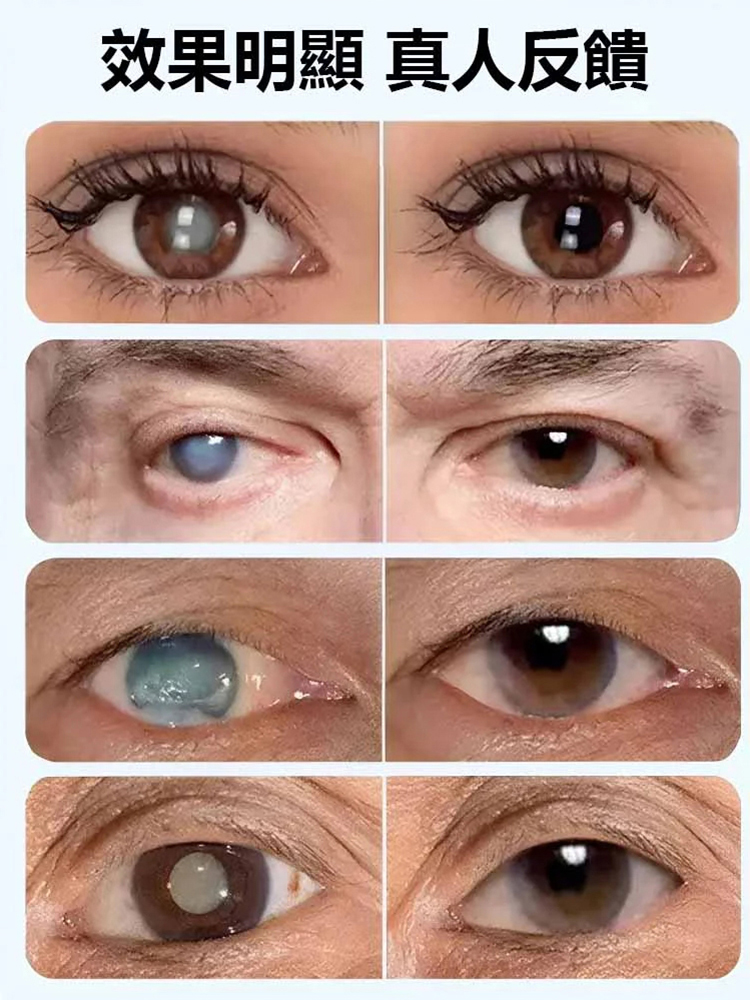 葉黃素精華熱敷蒸氣眼罩