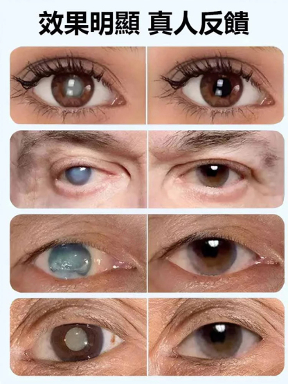 葉黃素精華熱敷蒸氣眼罩