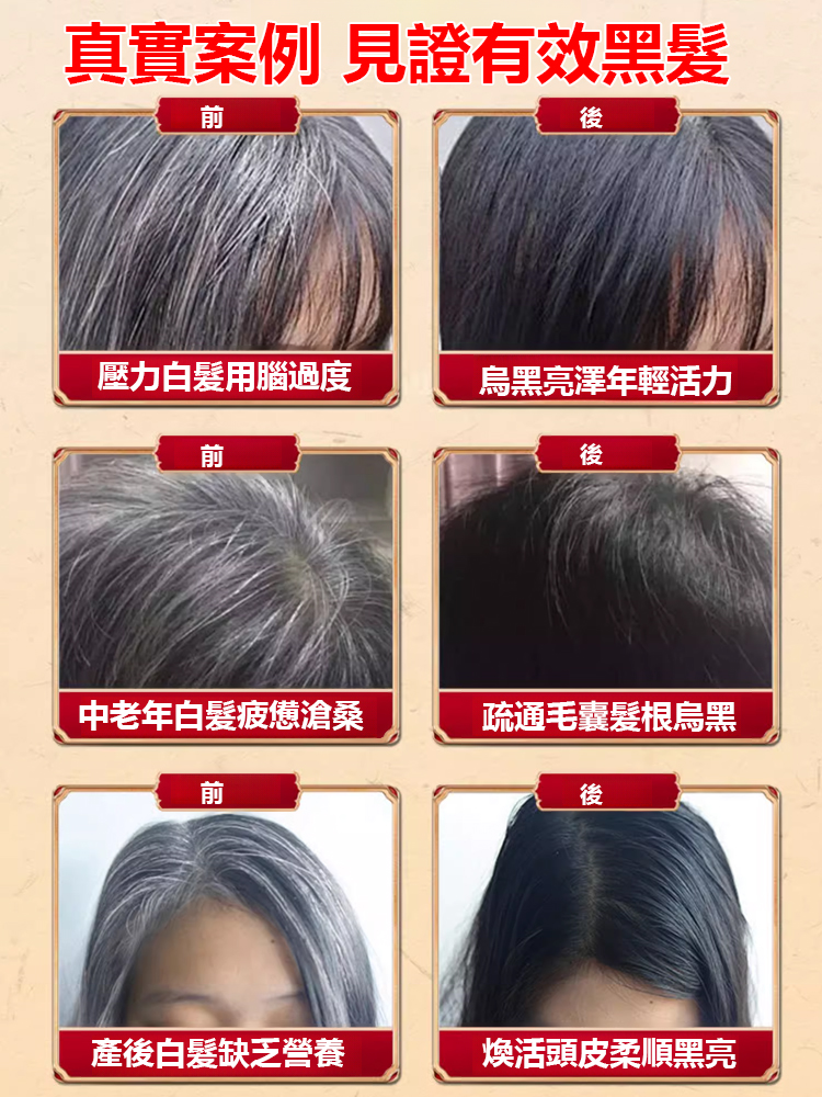 【白髮去無蹤】根源黑髮烏參九黑片