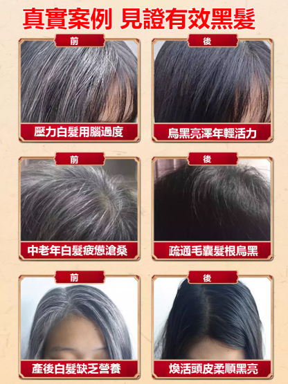 【白髮去無蹤】根源黑髮烏參九黑片