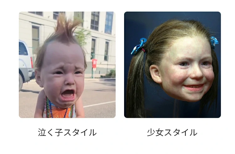 ヘッドギア