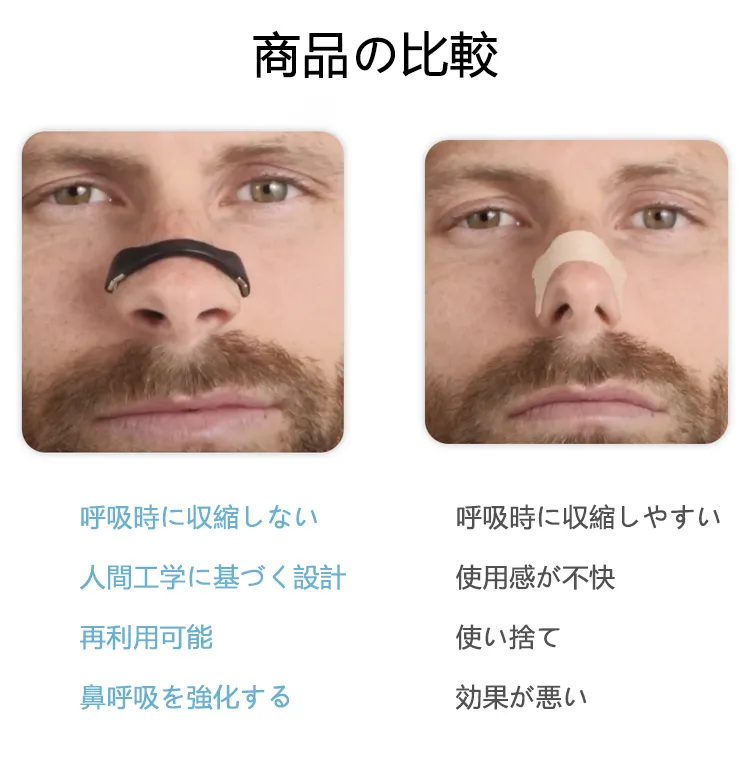 エキスパンダー