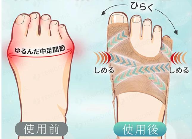 足指矯正スリーブ