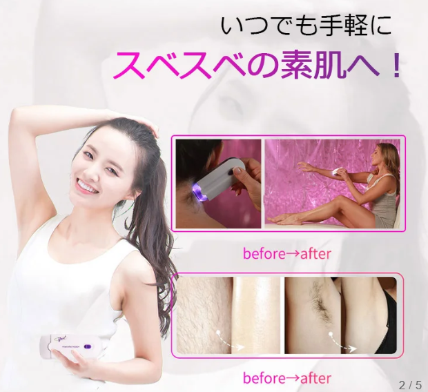 脱毛器