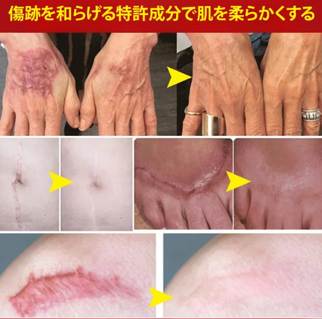 ゲル
