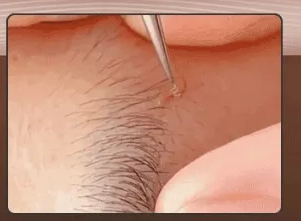 エキス