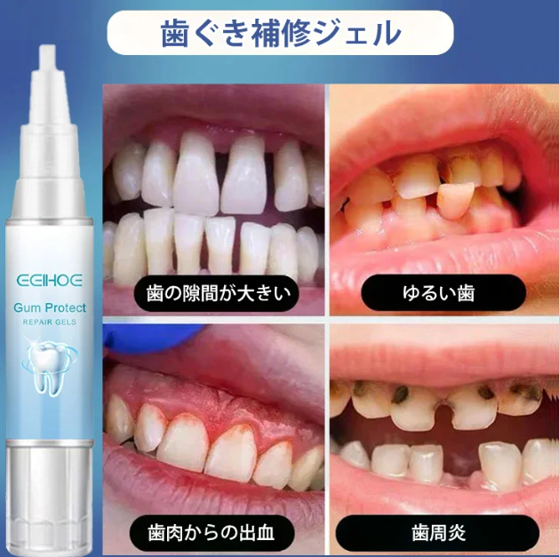 ゲル保護剤
