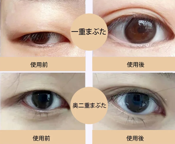 二重まぶたテープ