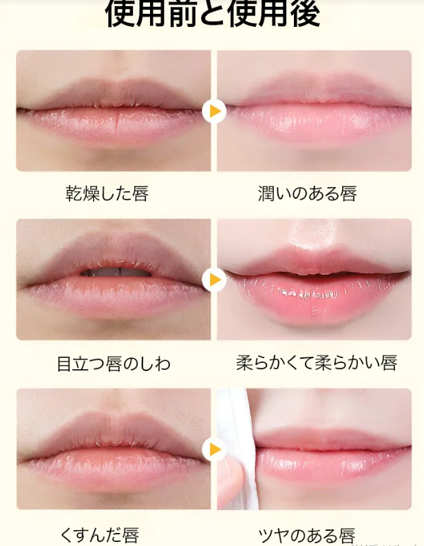 リップフィルム