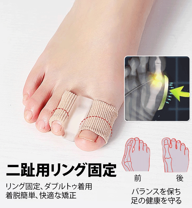 足指分離器