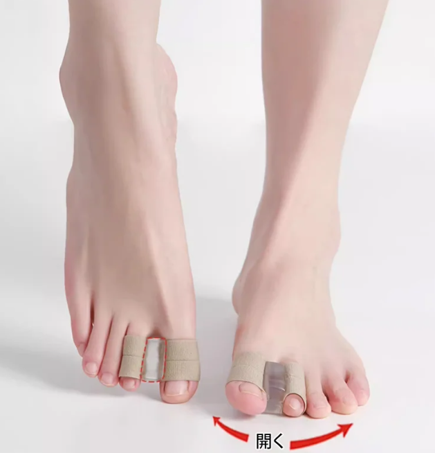 足指分離器