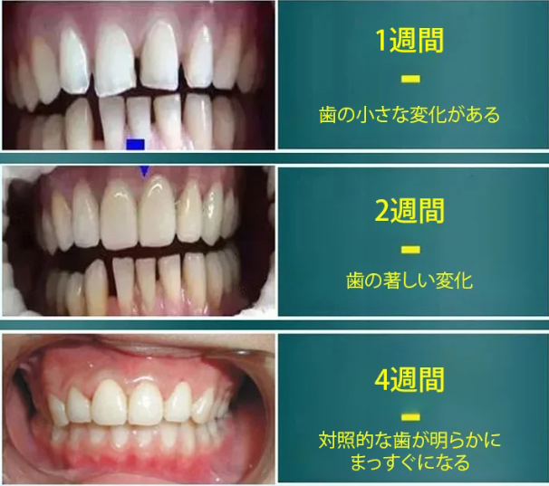歯磨き粉