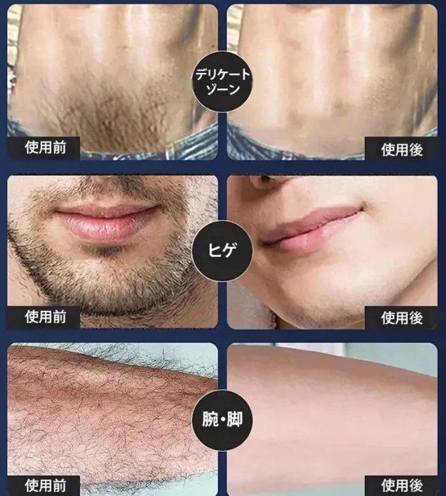 スクレーパ
